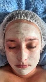 Skin Care Treatment JC's Beauty